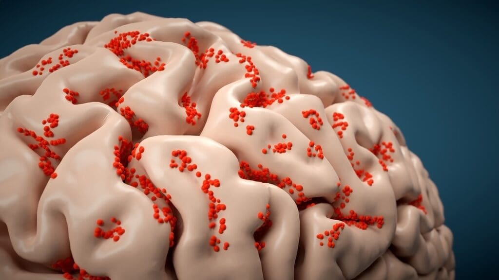 cerebrospinal fluid circulation