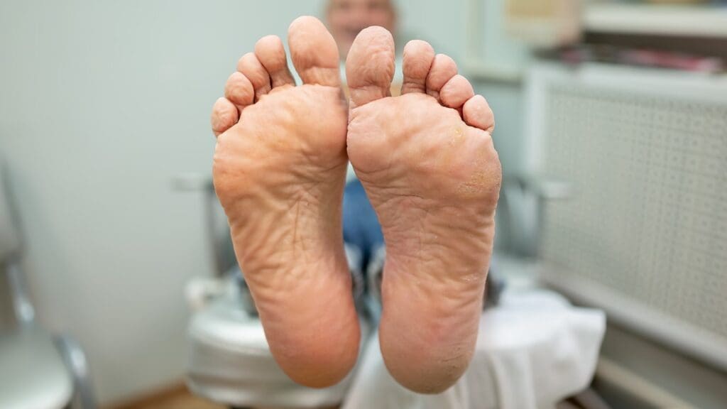 cold feet after knee surgery