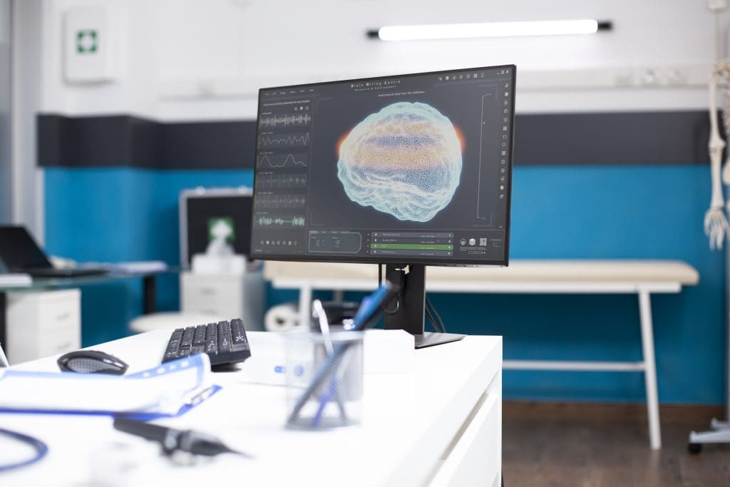 computer showing brain damage analysis LIV Hospital