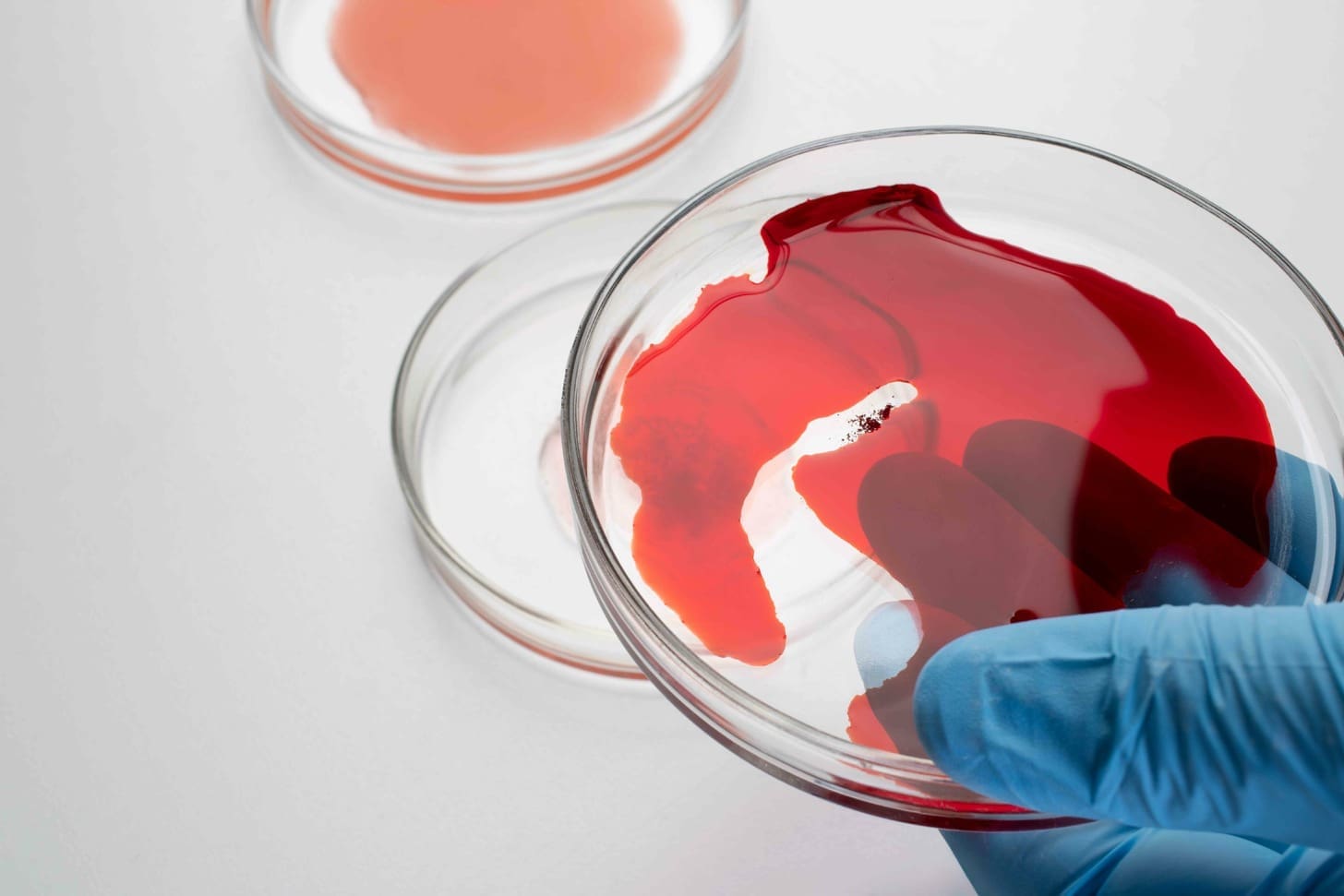 What Is Cord Blood and How Are Cord Blood Cells Used in Medicine?