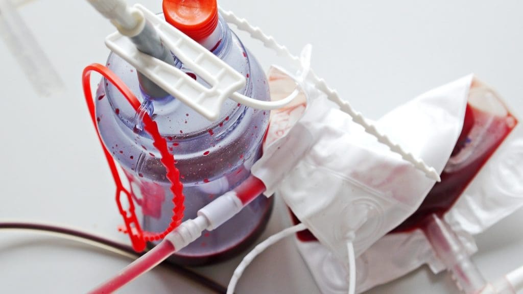 cord blood transplant process