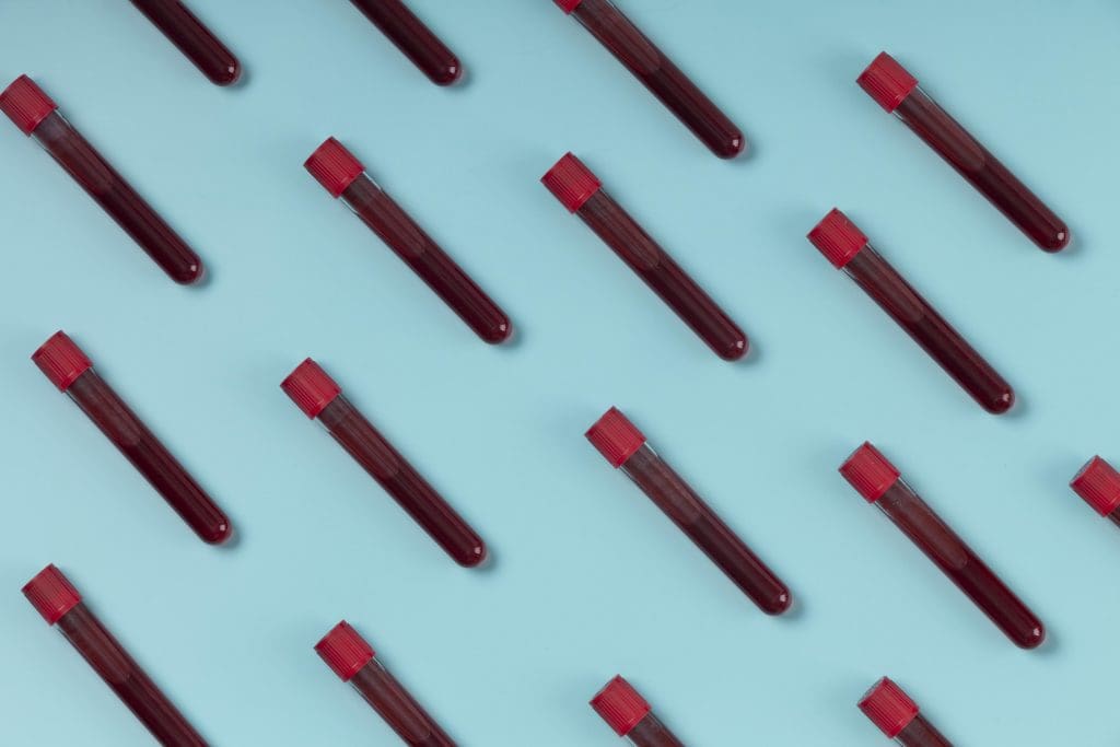 What is the Main Cause of Thalassemia? 1 What is the Main Cause of Thalassemia