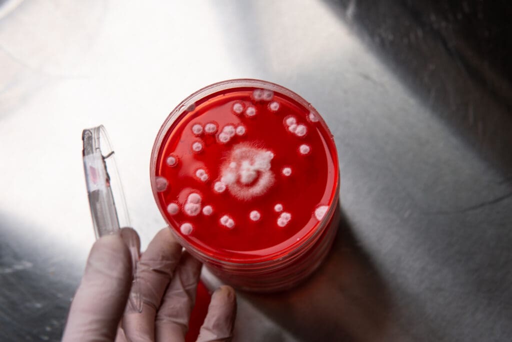 Vital Clarity: Is Hemophilia Caused by Inbreeding? 2 cropped hand person holding drink LIV Hospital