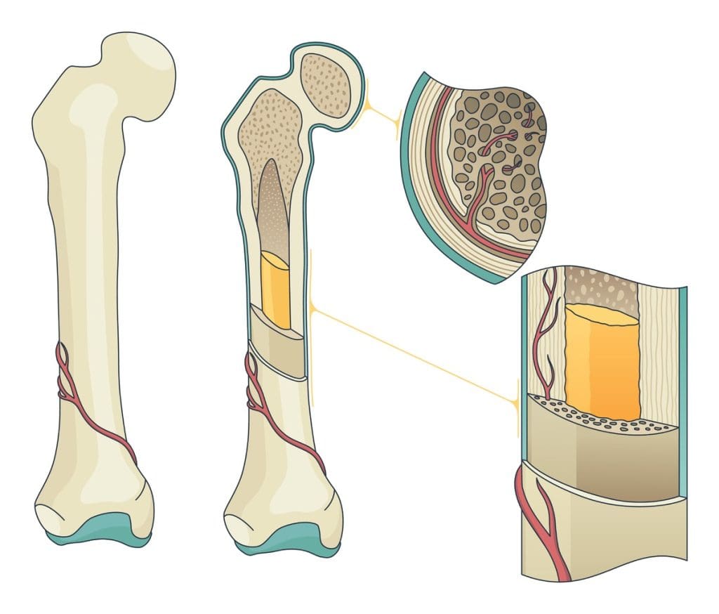 cross-section view of the bone marrow transplantation process