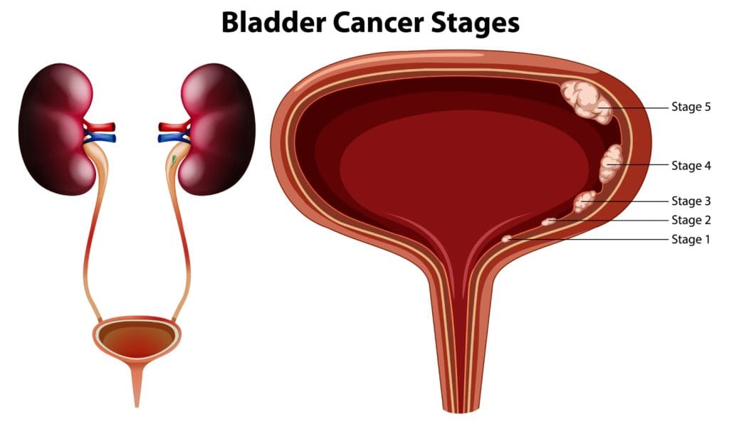 cross-sectional view of a human bladder
