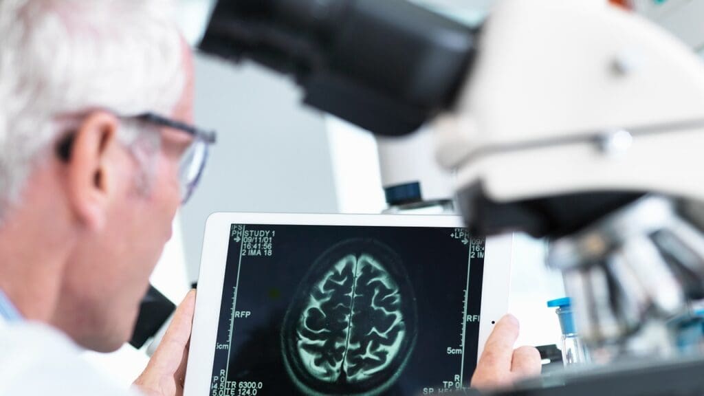 Cystic Lesion Brain: 7 Key Facts About Causes, Symptoms, and Treatment