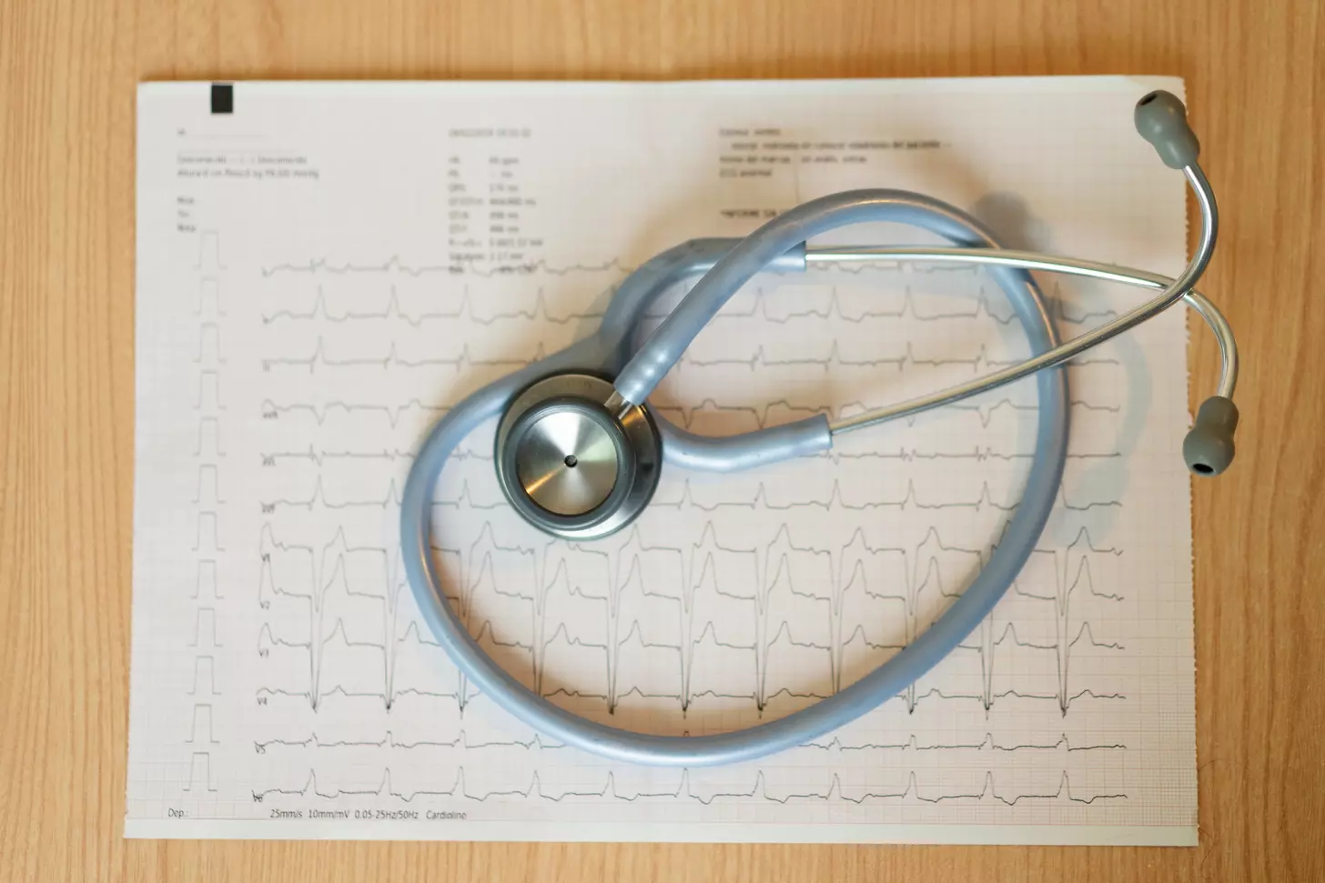 definition of sinus arrhythmia