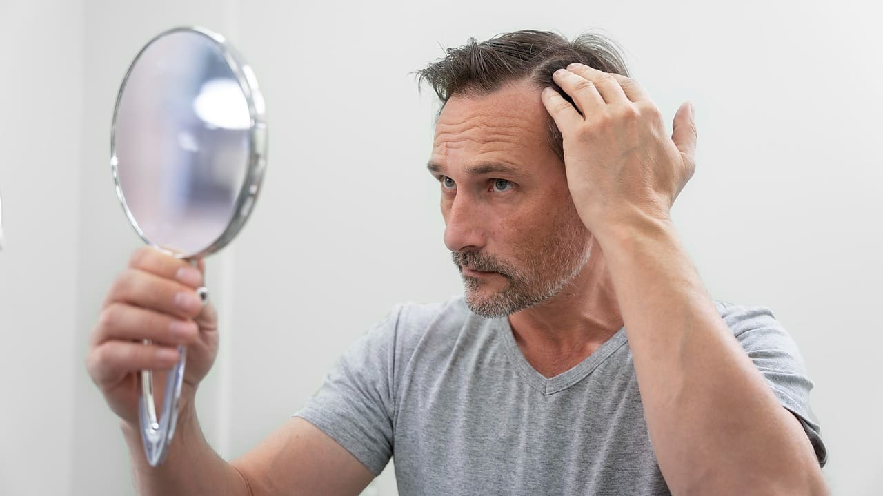 do brain tumors cause hair loss