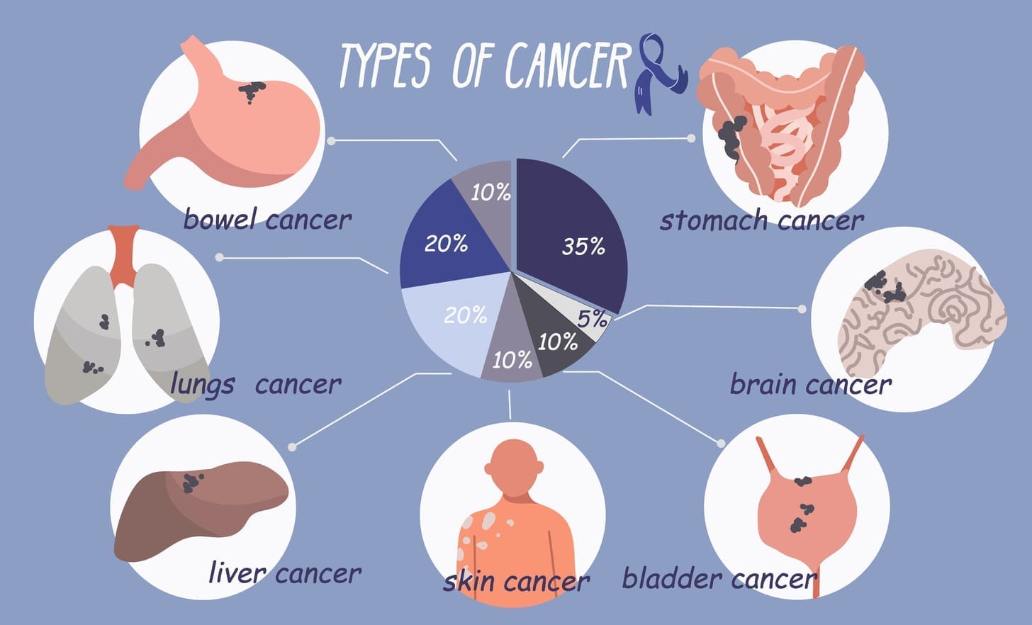 examples of neoplasm