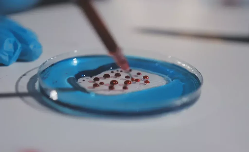 haematopoietic stem cell transplantation hsct