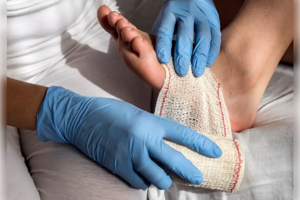 heal from bunion surgery