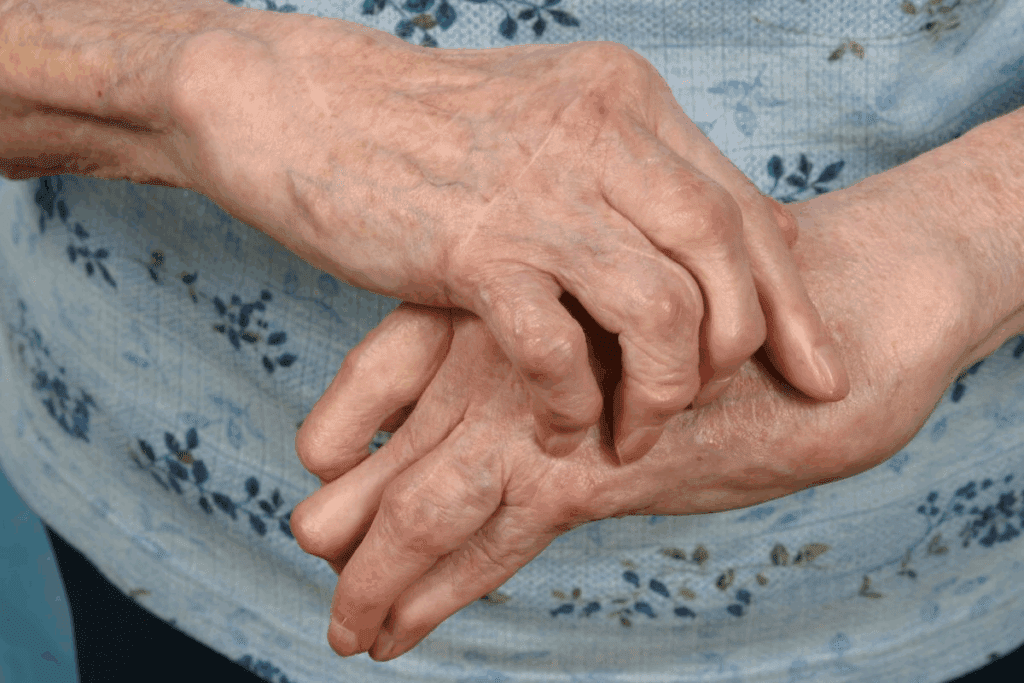 How to Naturally Calm Osteoarthritis Pain and Swelling