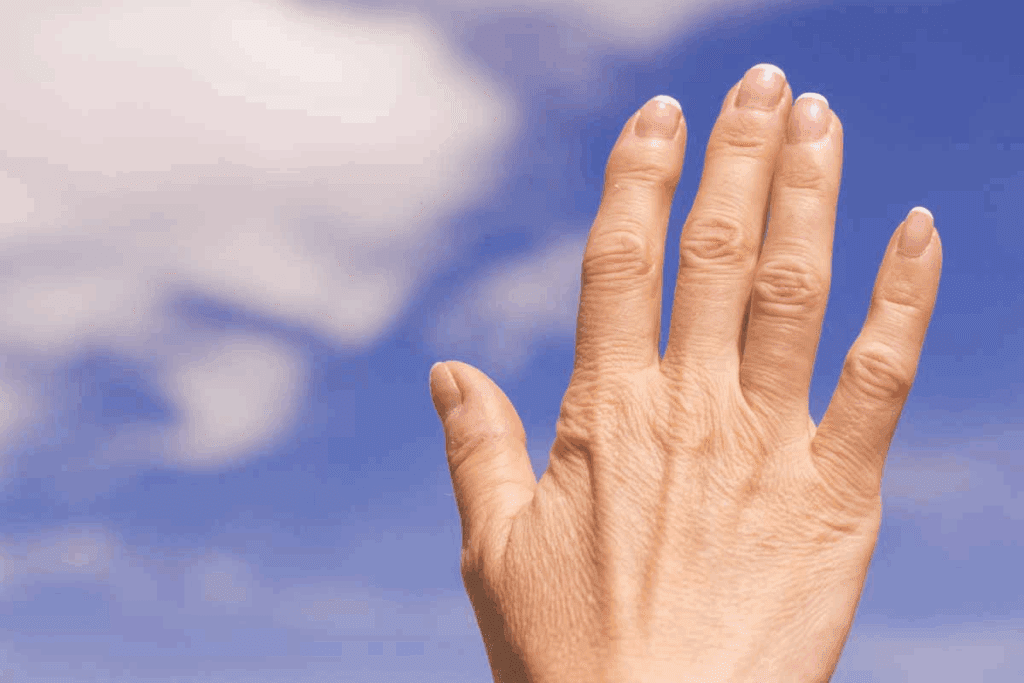 Managing Psoriatic Arthritis Inflammation Effectively