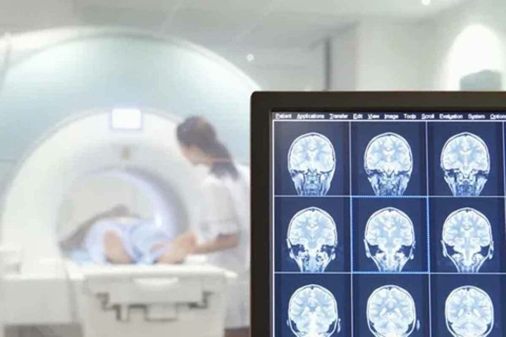 Brain Tumor MRI: 10 Key Findings