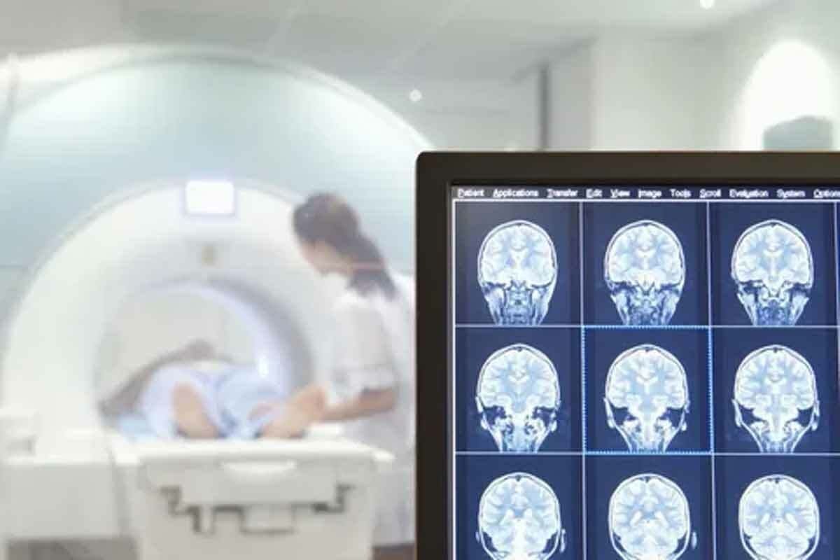 Brain Tumor MRI: 10 Key Findings