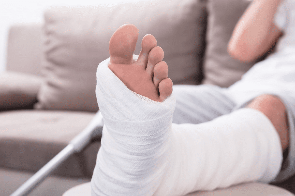 Types of Bone Fractures: The 4 Crucial Categories Uncovered
