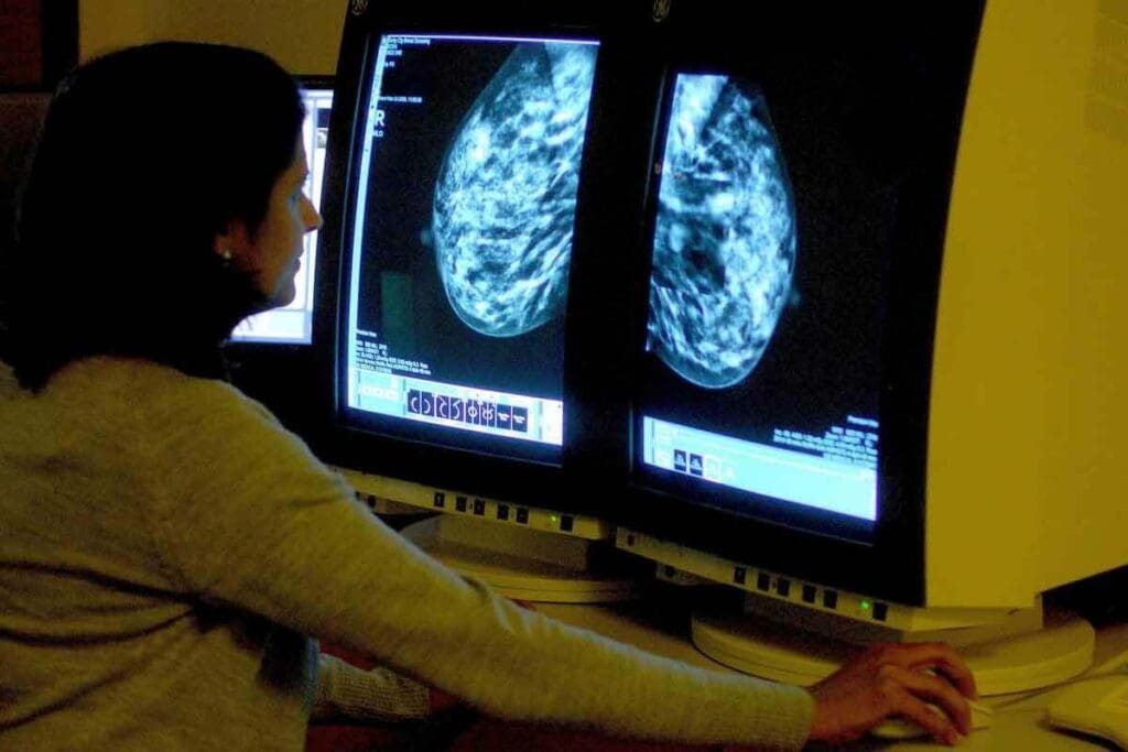 CT Scan Pics: 12 Facts About How CT Works 2 CT Scan Pics: 12 Facts About How CT Works