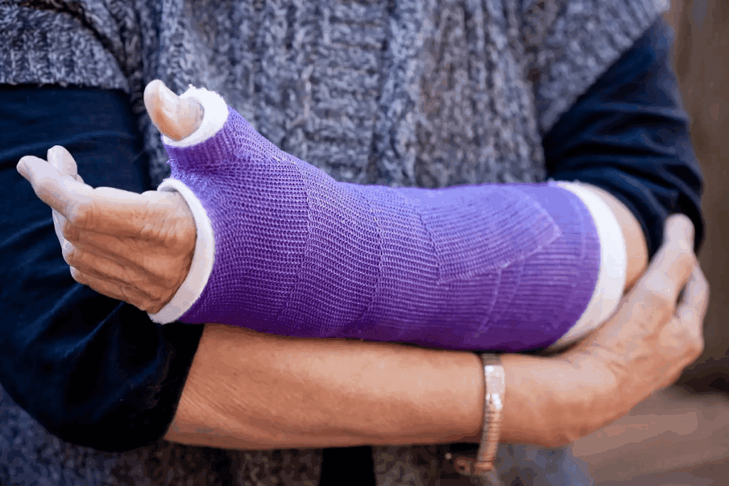 Fracture vs Break: How to Tell the Difference 2 Fracture vs Break: How to Tell the Difference