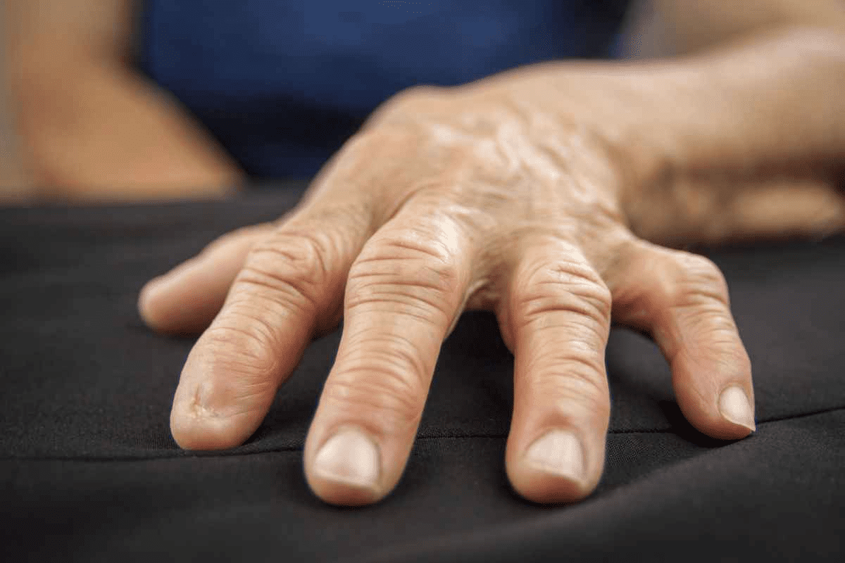 Joint Supplements for Stiff Joints Relief