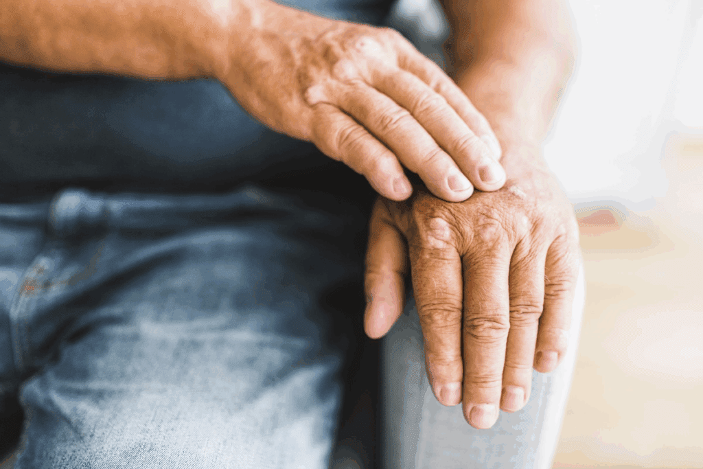 Connection Between Scoliosis and Arthritis Explained