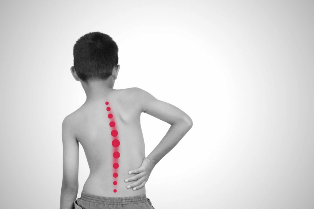 Scoliosis Organ Impact: The Crucial Organ Most Affected by the Curve