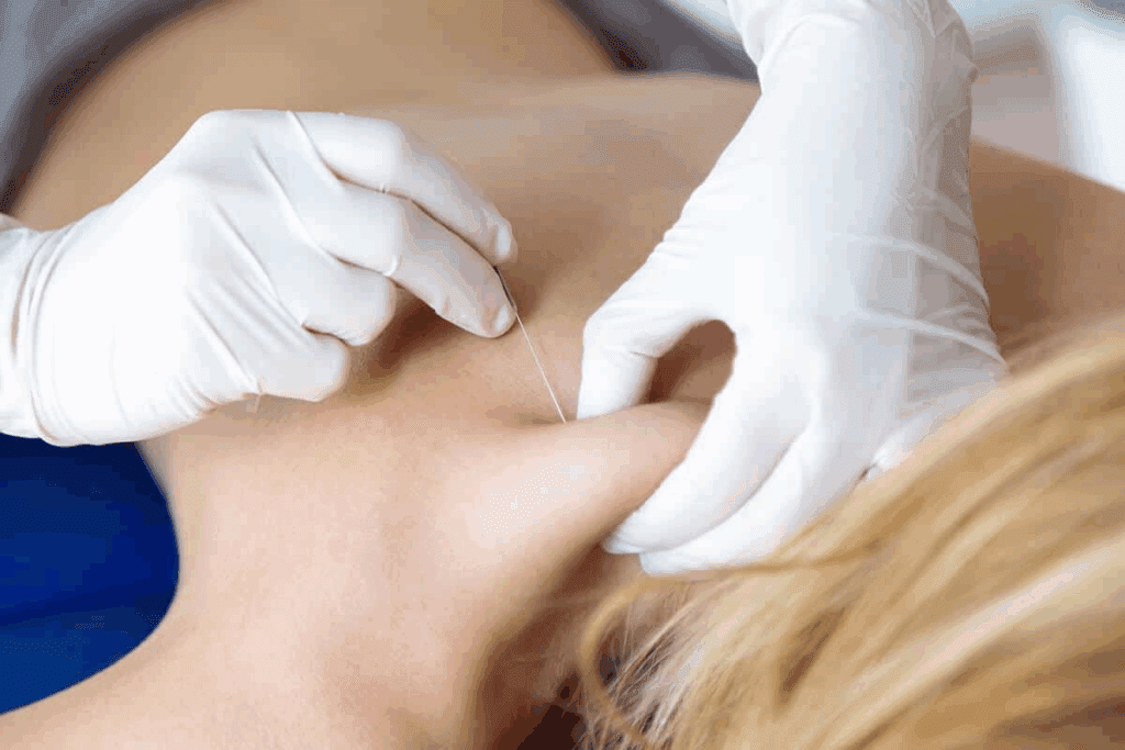 The Truth About the dark side of epidural steroid injection