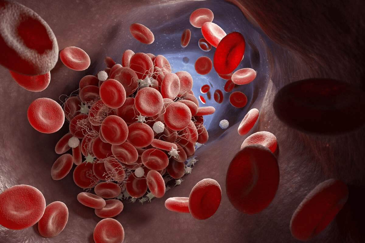 Dietary Factors: nutritional deficiency low platelets Link
