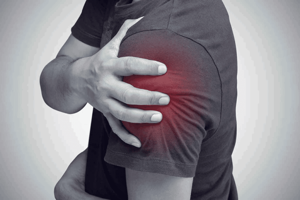 How an MRI for Shoulder Bursitis Detects Inflammation