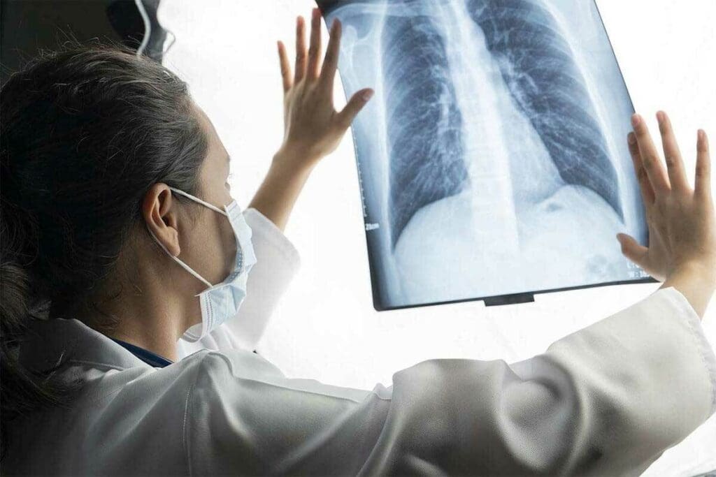 X Rays Cause Cancer? Risk & Safe Exposure Levels