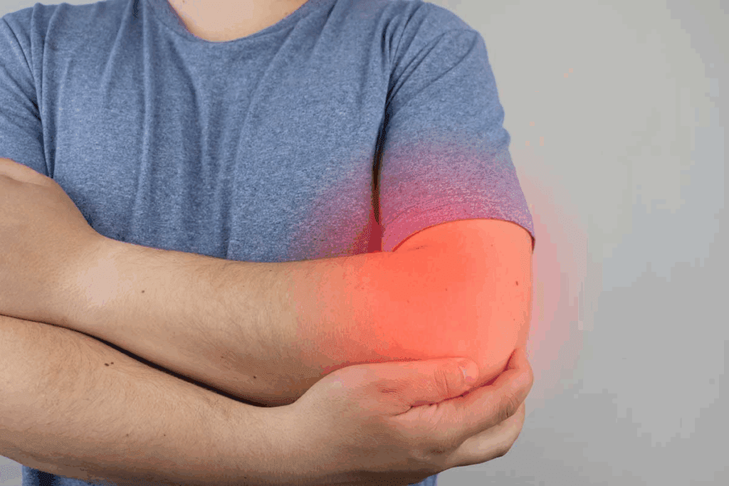 Why Bursitis Pain Feels So Intense