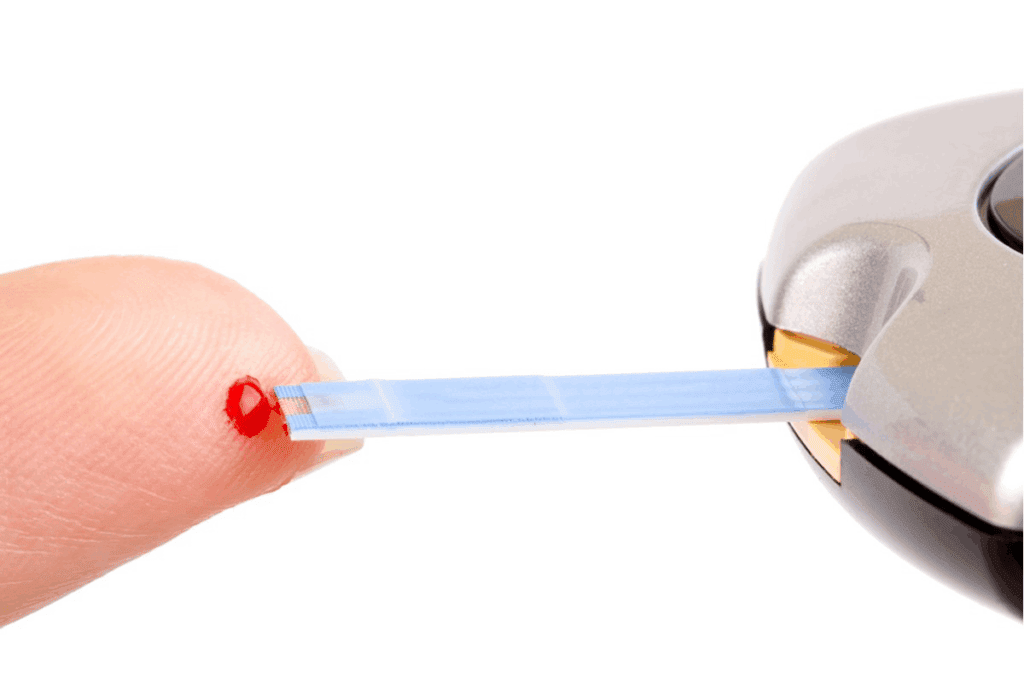 Can a Blood Test for Carpal Tunnel Confirm It? 2 Can a Blood Test for Carpal Tunnel Confirm It?