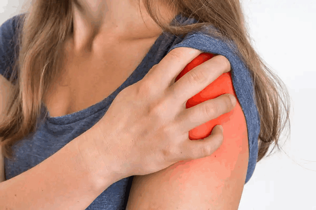 What Are the Symptoms of Bursitis Shoulder