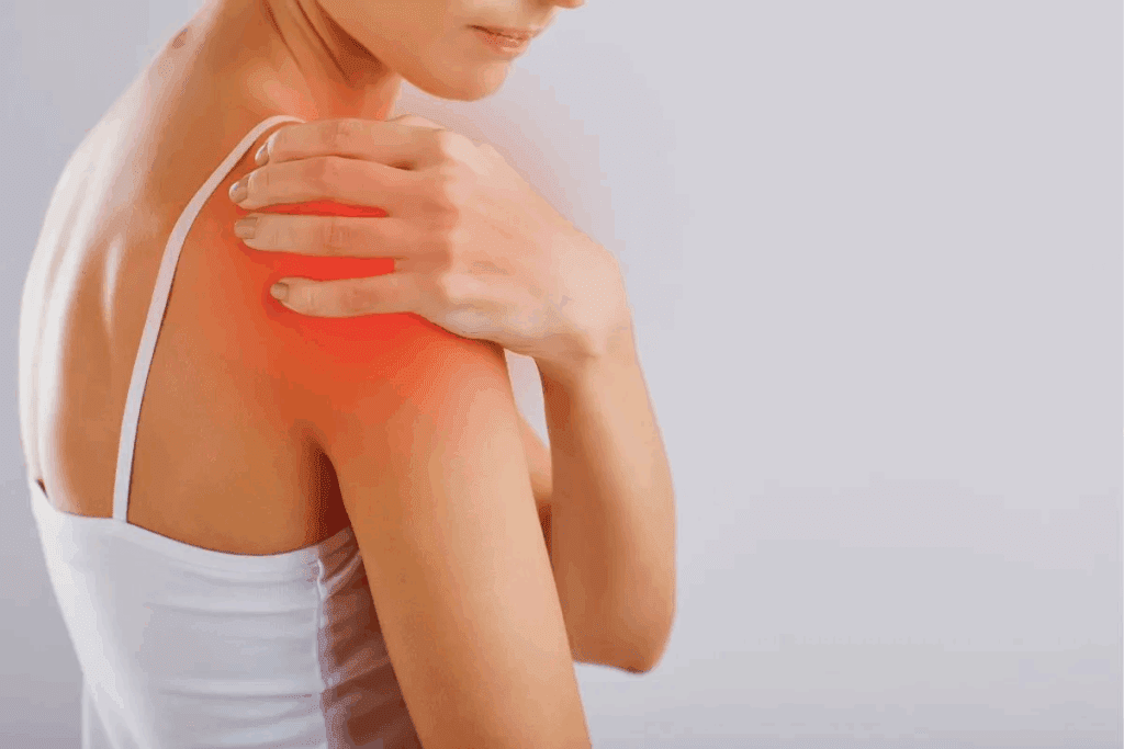 What Are the Four Stages of Shoulder Impingement? Anterior Impingement Syndrome Shoulder