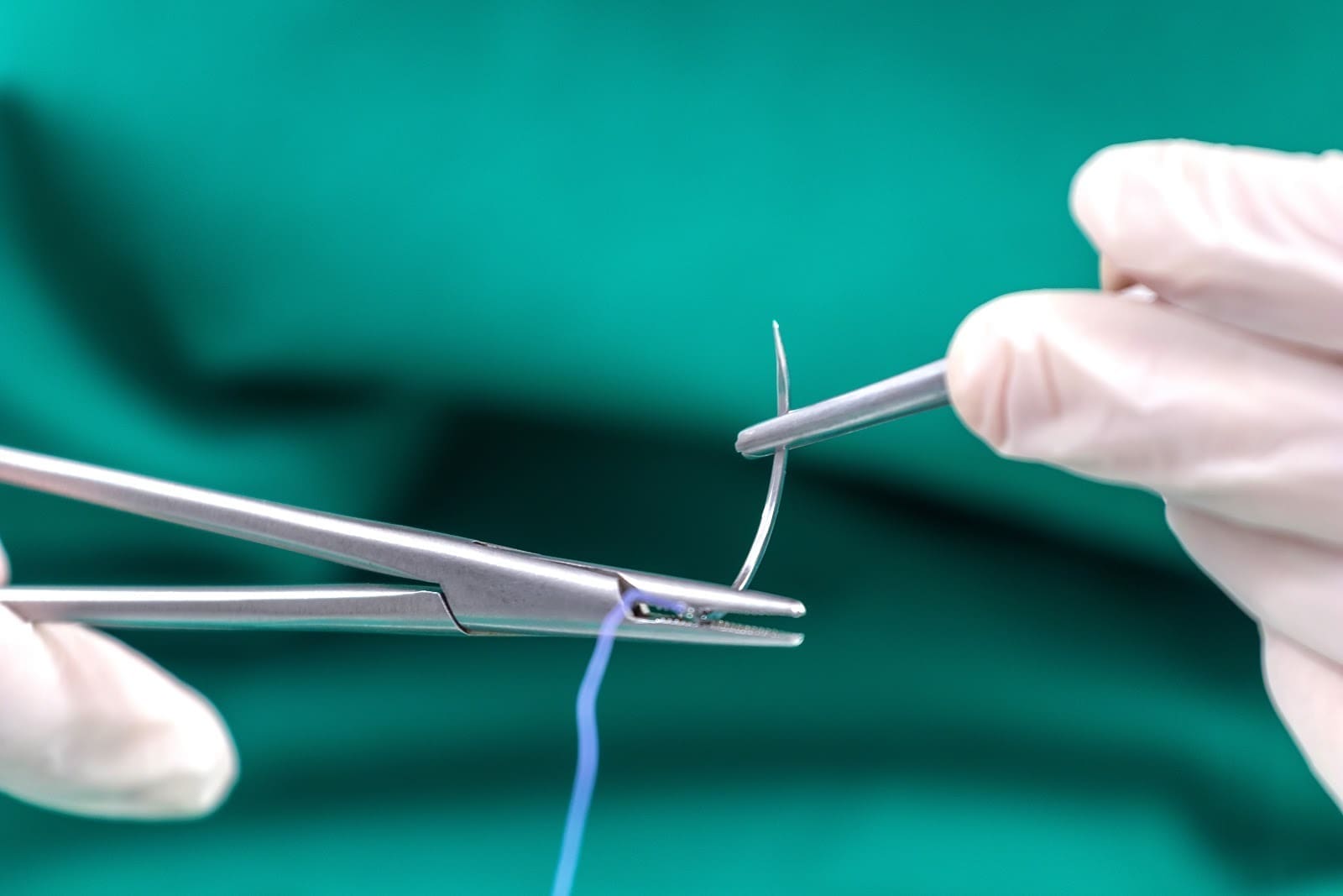 Urethroplasty Guide: How Long is the Catheter In Place?