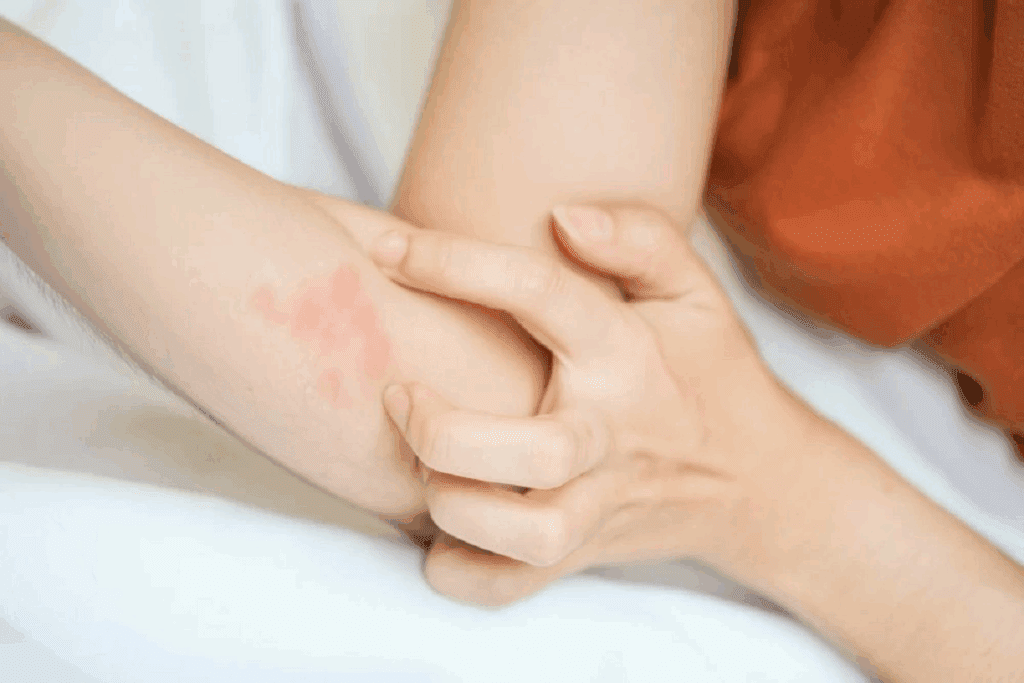 Petechiae from Scratching: What to Know 3 Petechiae from Scratching: What to Know