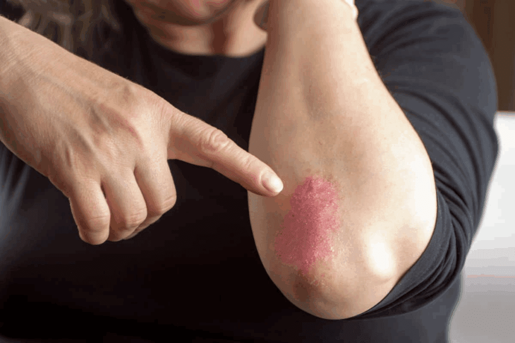 Blood Disease Symptoms Skin: 12 Early Signs