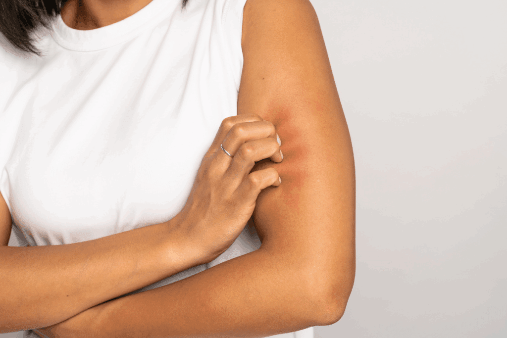 Does Petechiae Itch? Causes Explained