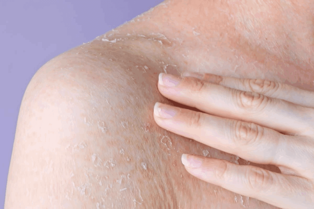 Can Itching Cause Petechiae? Facts