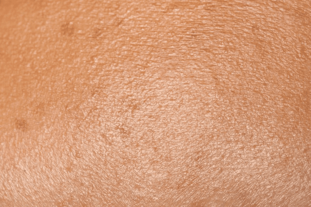 Can Itching Cause Petechiae? Facts