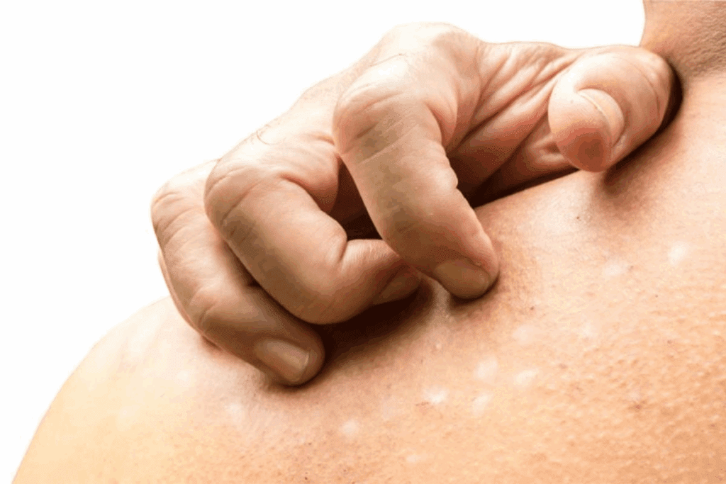 Itchy Skin Rash and Bruising: 7 Causes 3 Itchy Skin Rash and Bruising: 7 Causes