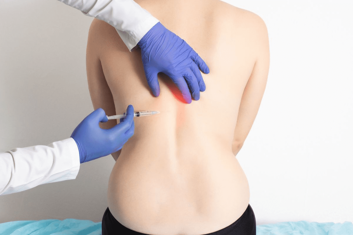 Steroid Injection for Herniated Disc: Frequency & Safety