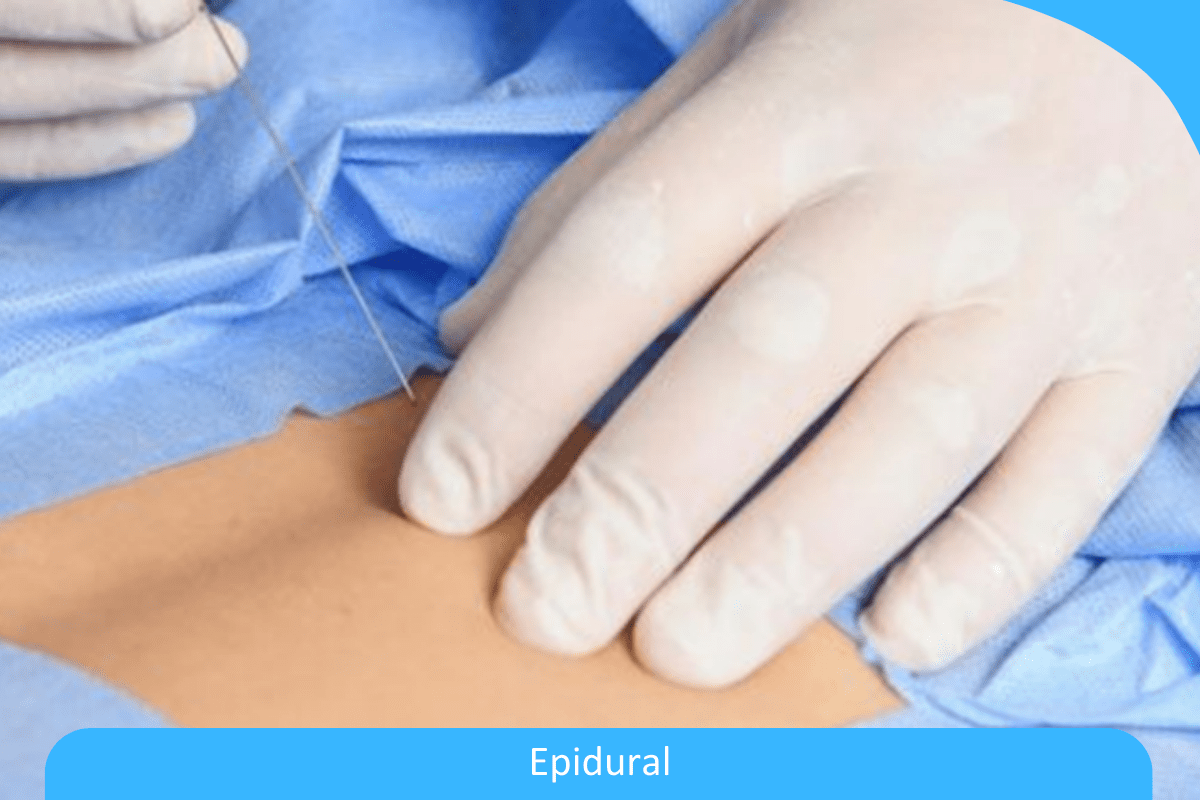 How Long Does an Epidural Shot Last? Back Pain
