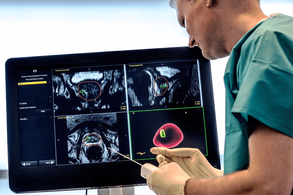 Prostate MRI: Crucial Time for Urology Scan