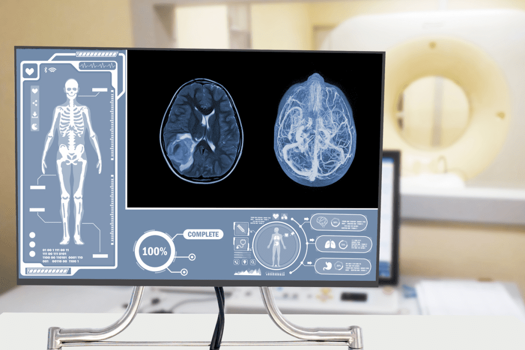 CT Contrast Side Effects: Crucial & Alarming Post-Scan Tiredness 1 CT Contrast Side Effects: Crucial & Alarming Post-Scan Tiredness