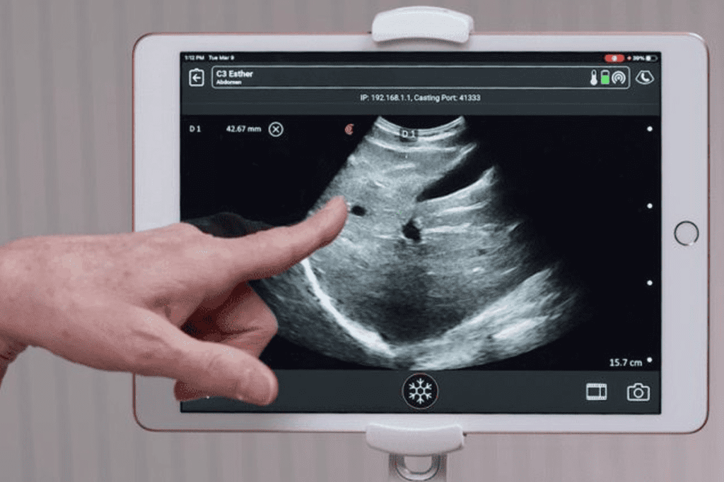 Uroflowmetry vs. Bladder Sonogram: Are They the Same?
