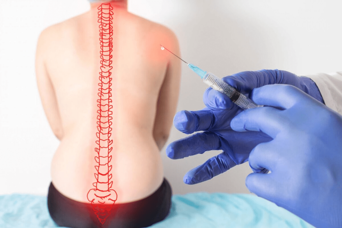 Facet Block Injection: Quick Relief for Back Pain