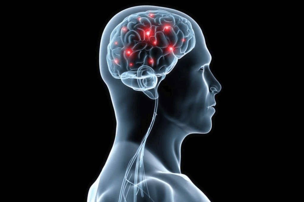 Does Underactive Thyroid Cause Anxiety?