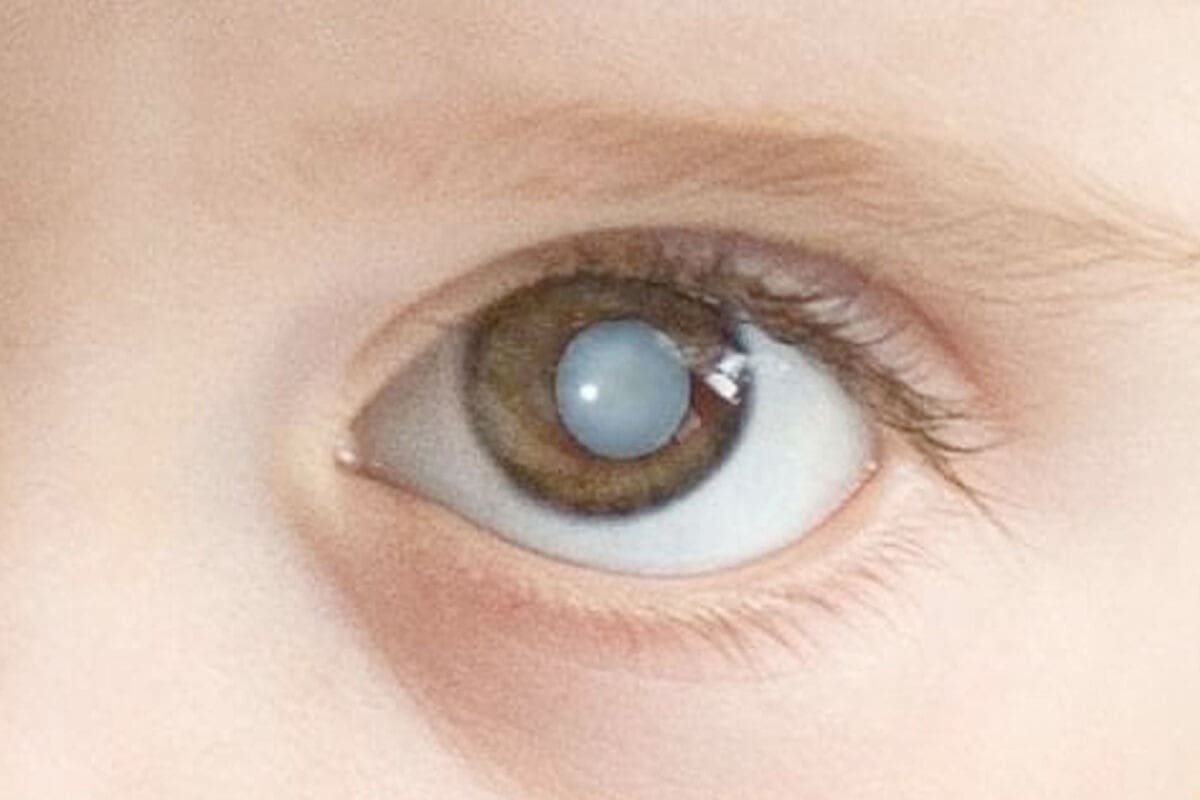 Classic Congenital Anomaly Example: Conditions Explained