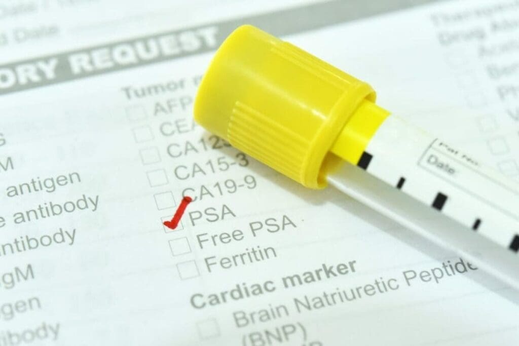 Why PSA Test Not Recommended After 70 | My PSA Is 56