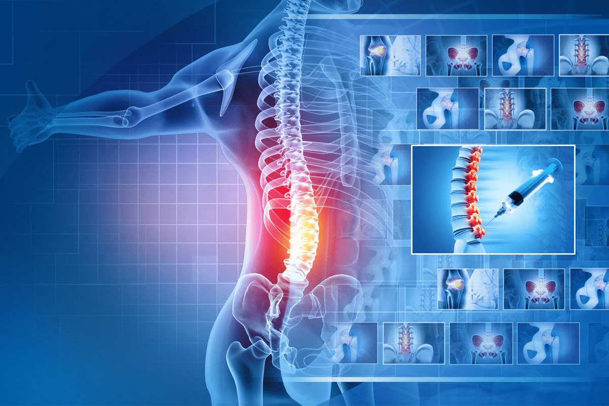 Facet Shots: Step-by-Step Guide for Relief